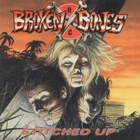 Broken bones - Stitched up