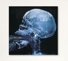 X-Ray Gagging Urban Pop Art Skull Kunst Chanel Porn Röntgen