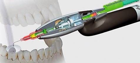 Topcase: RHINSendo – Nuovo e nell'imballaggio originale da Pfeffingen venduto da rov_9frp 4