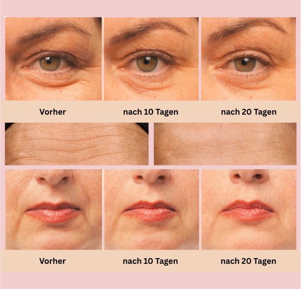 Cura del viso: Anti - Aging Verjüngerungsgerät neu – Nuovo e nell'imballaggio originale da Trimbach venduto da Alessia75 2