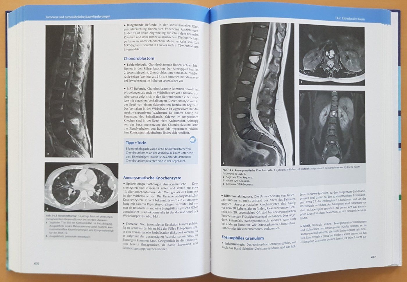 Libri: Sachbuch "MRT des Zentralnervensystems" – Usato da Schaffhausen venduto da asyouwestley 3
