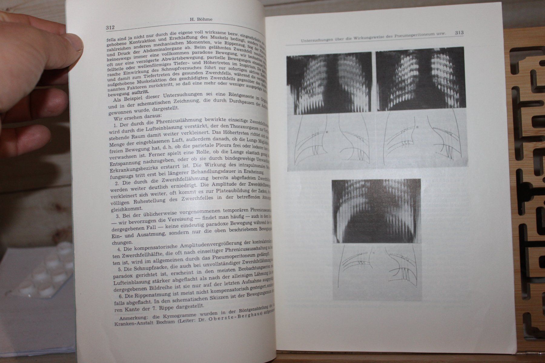Libri: Der Tuberkulosearzt Juni 1950 – Usato da Urdorf venduto da Buchprofi 1