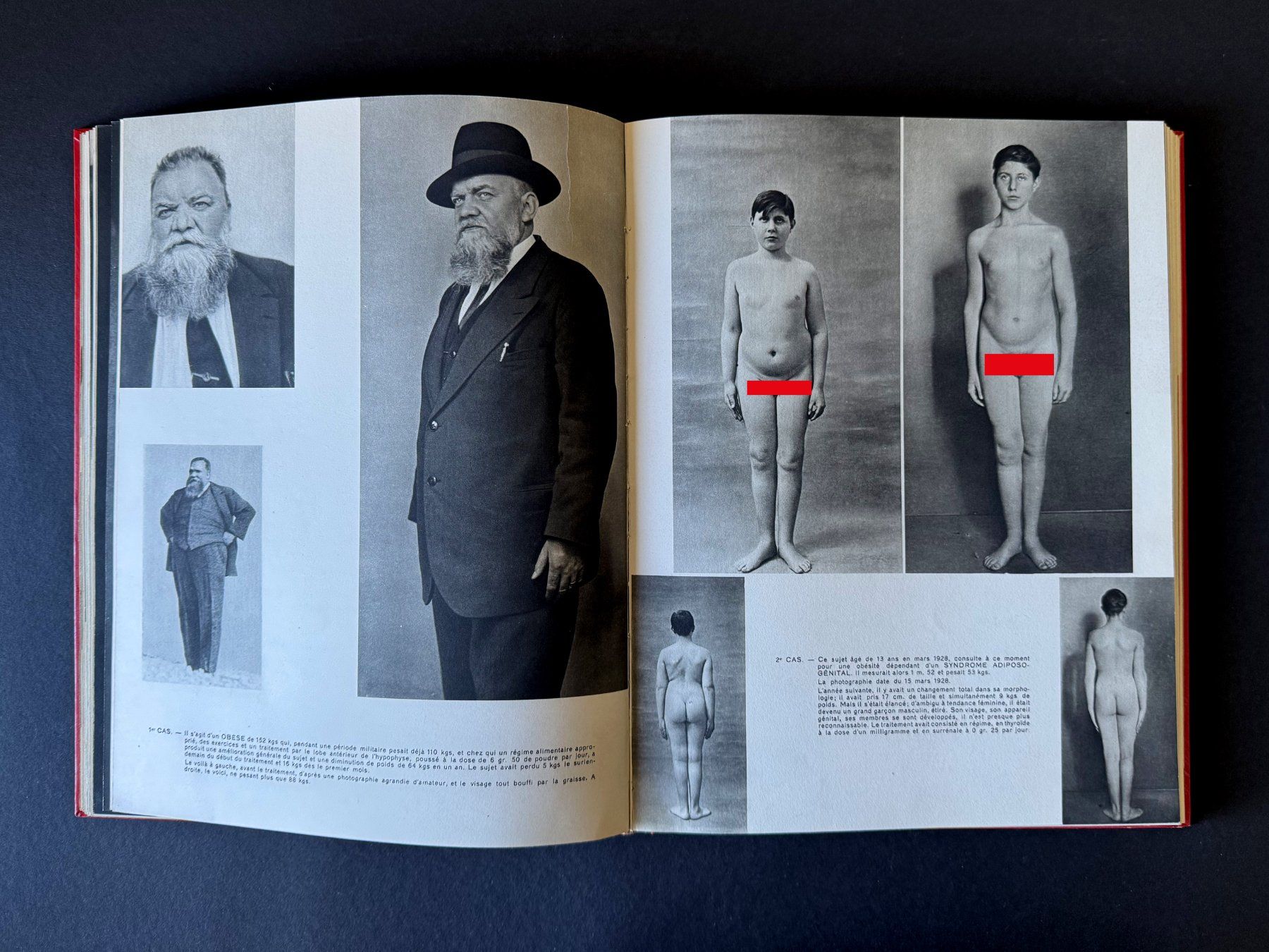 Libri: La collection des Documents Médicaux. Robert Lang. Paris. – Usato da Zürich venduto da Tulsa1968 4
