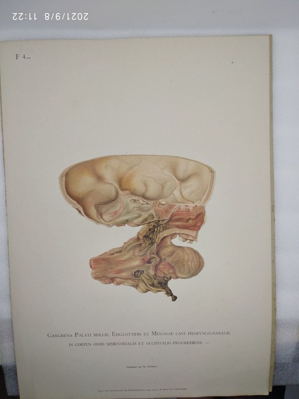 Libri: MEDIZIN - ANATOMIE - KAST - RUMPEL - P – Usato da Goldach venduto da Gaip 2