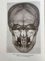 Anatomie des menschlichen Körpers im Röntgenbild. 1926