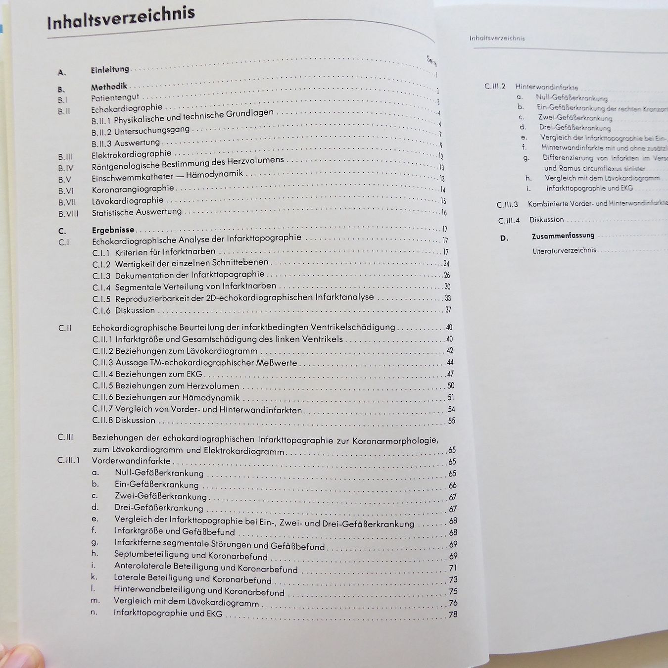 Bücher: Qualitative und quantitative 2D-echokardiographische Topogra – Gebraucht aus Basel von Kunterbunt12 2