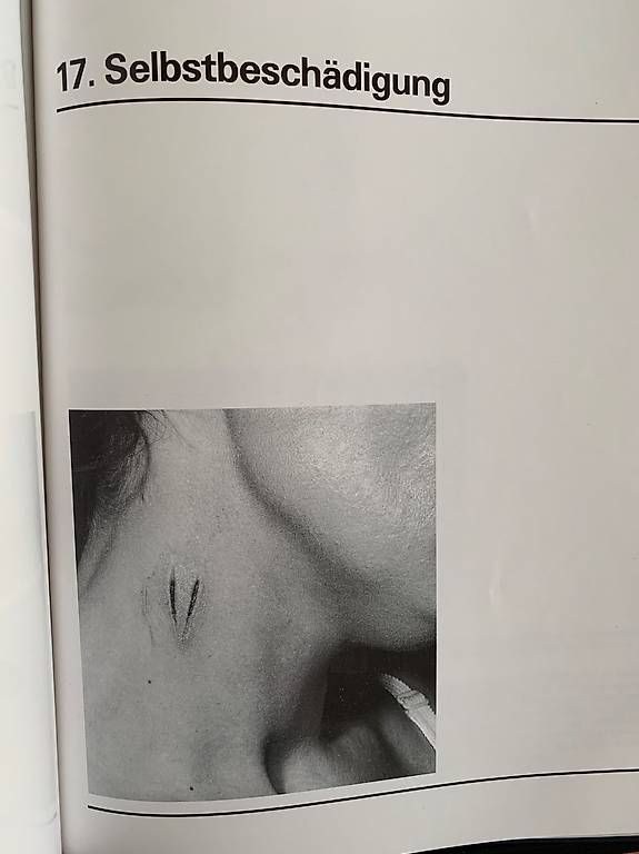 Libri: Atlas der gerichtlichen Medizin – Nuovo (secondo la descrizione) da Zürich venduto da Mordes 4