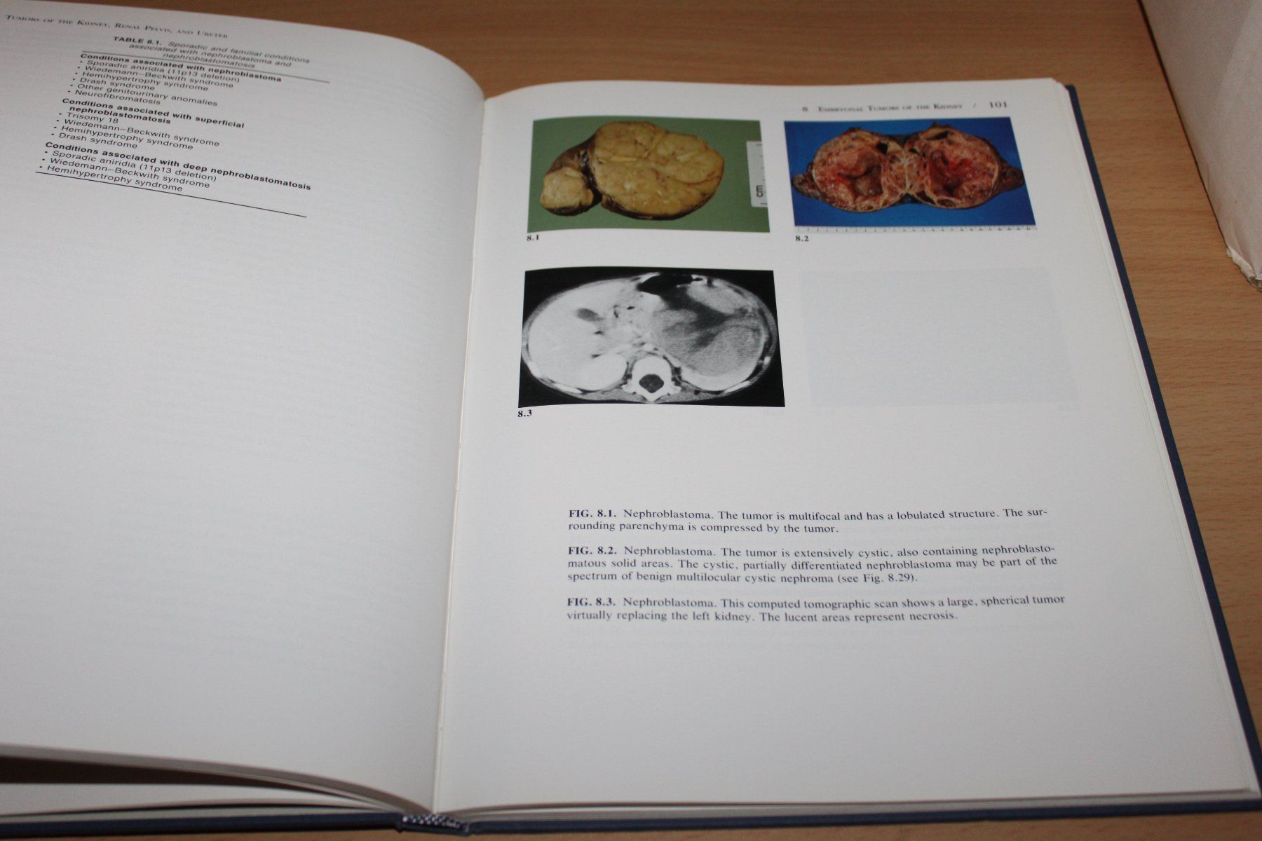Bücher: Urinary Tract Pathology: An Illustrated Practical Guide – Gebraucht aus Kaden von Buchantiquariat 3