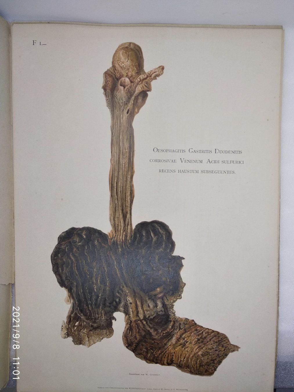 Libri: MEDIZIN - ANATOMIE - KAST - RUMPEL - P – Usato da Goldach venduto da Gaip 4