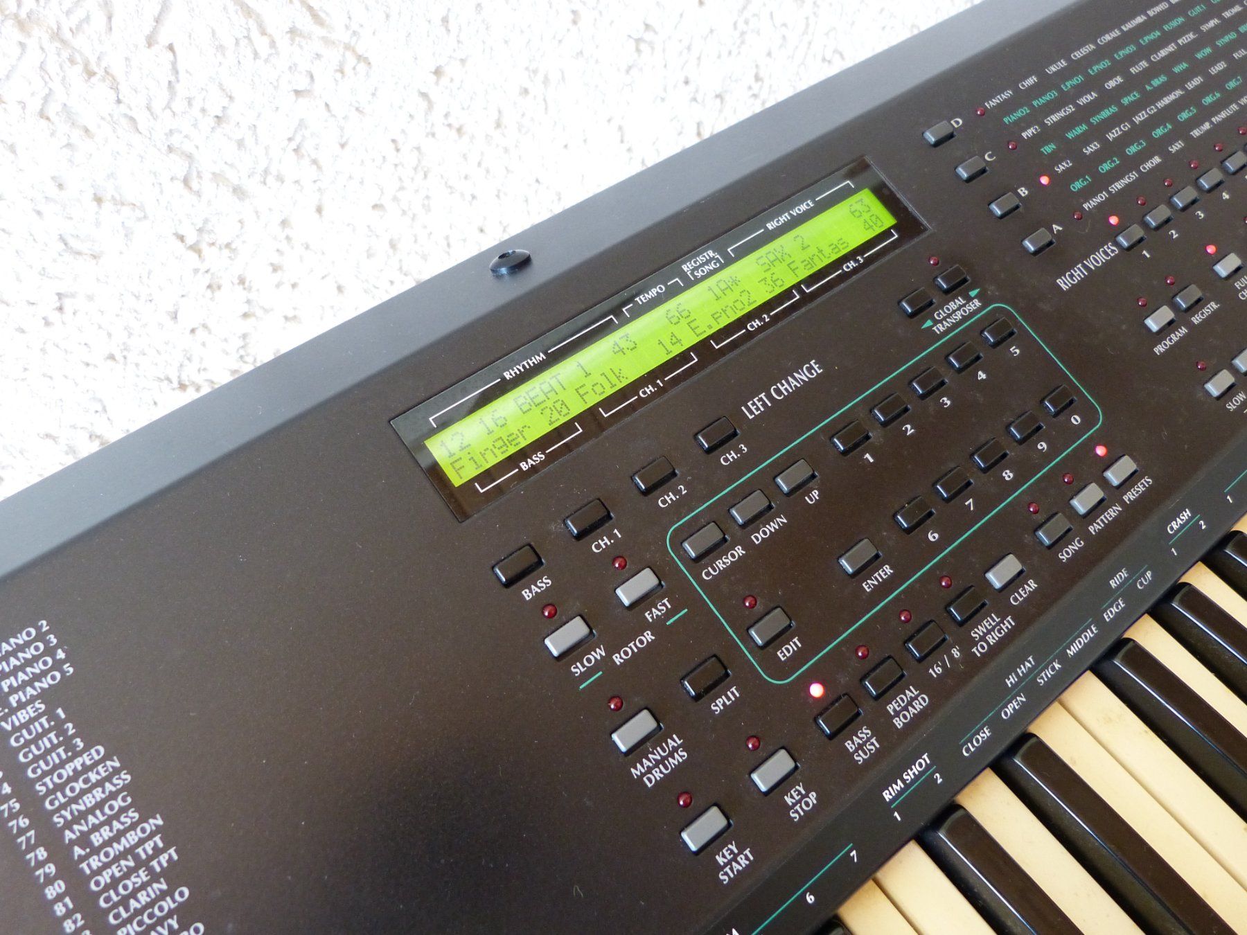 Solton Strumenti musicali: Solton MS 5 Multi Synthesis Keyboard + Koffer + 2 Pedalen – Usato da Rheineck venduto da mur.man 5