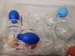 Schröpfgläser alle Varianten und Durchmesser
