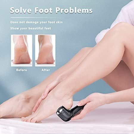 Rasierapparate & Rasierklingen: Fußpflegegerät Electric Foot File – Neu (gemäss Beschreibung) aus Thun von keller001 3