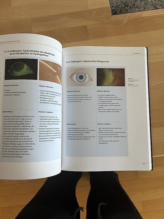 Livres: Optik: Spaltlampenbefunde – D'occasion à St. Gallen par mar_fl6v 1