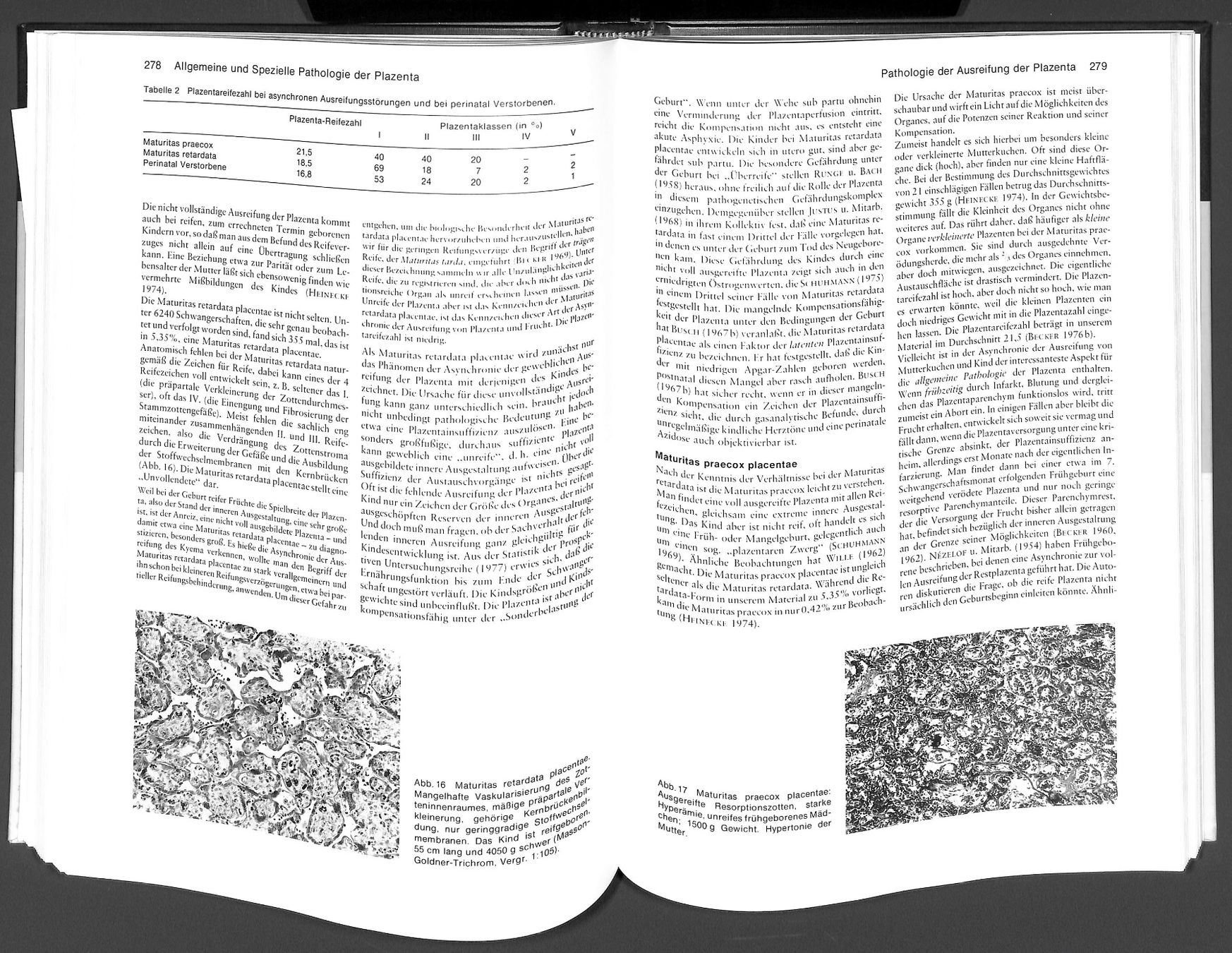 Libri: Die Plazenta des Menschen V. BECKER & T.H. SCHIEBLER - – Nuovo (secondo la descrizione) da Zürich venduto da Nobs1 4