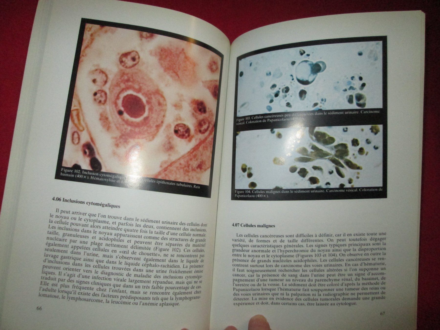 Libri: L'urine vue au microscope – Usato da Neuchâtel venduto da Dualseele 4