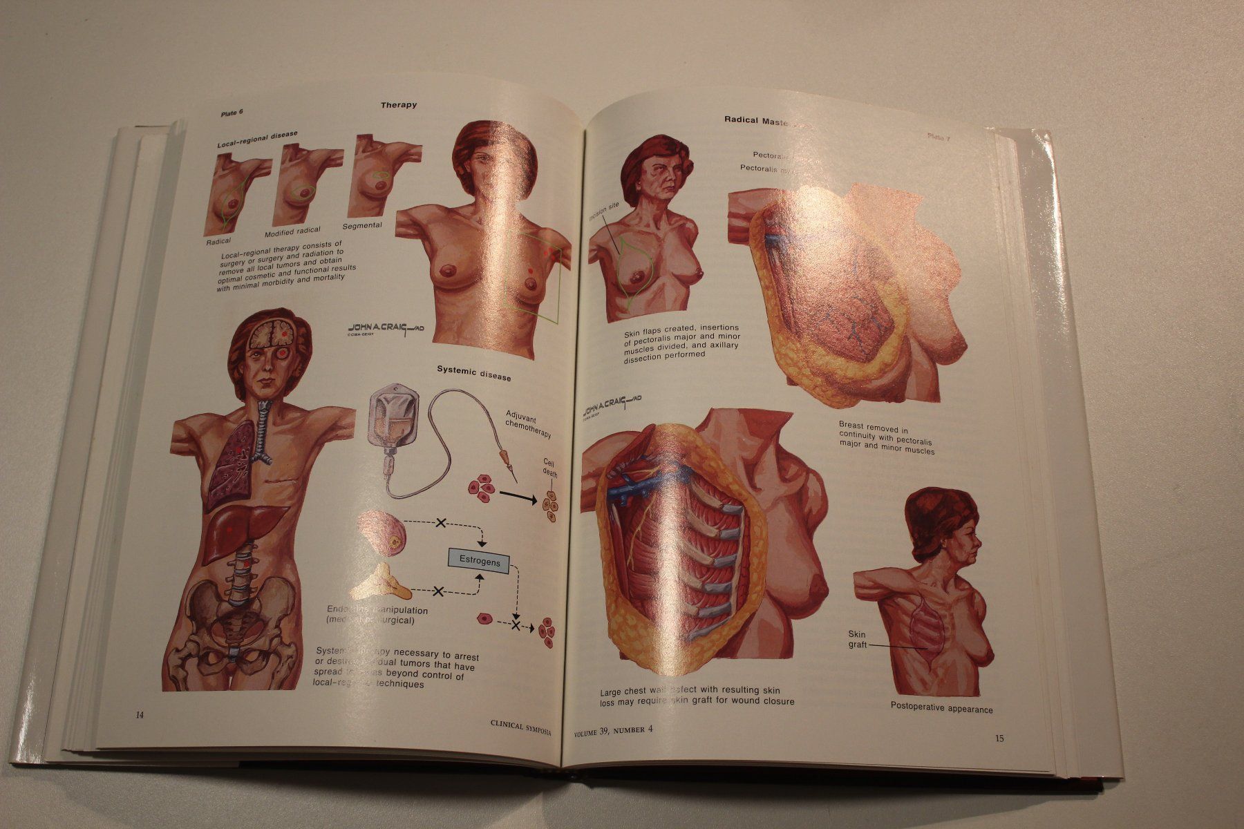 Libri: Clinical Symposia 1987 - Frank Netter – Nuovo (secondo la descrizione) da Staufen venduto da qualiton 4