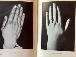Handlesen, "Der Mensch im Spiegel der Hand", Dürckheim, EA