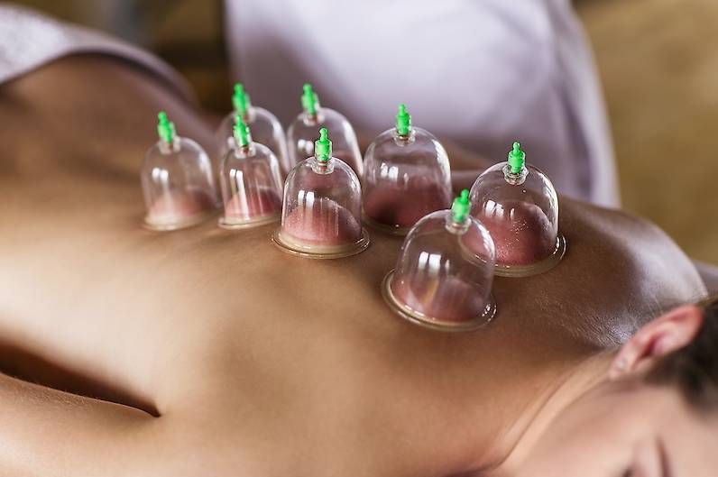 Dispositivi per massaggi: Schröpfen gegen Schmerzen – Usato da Chur venduto da fitundheil 1