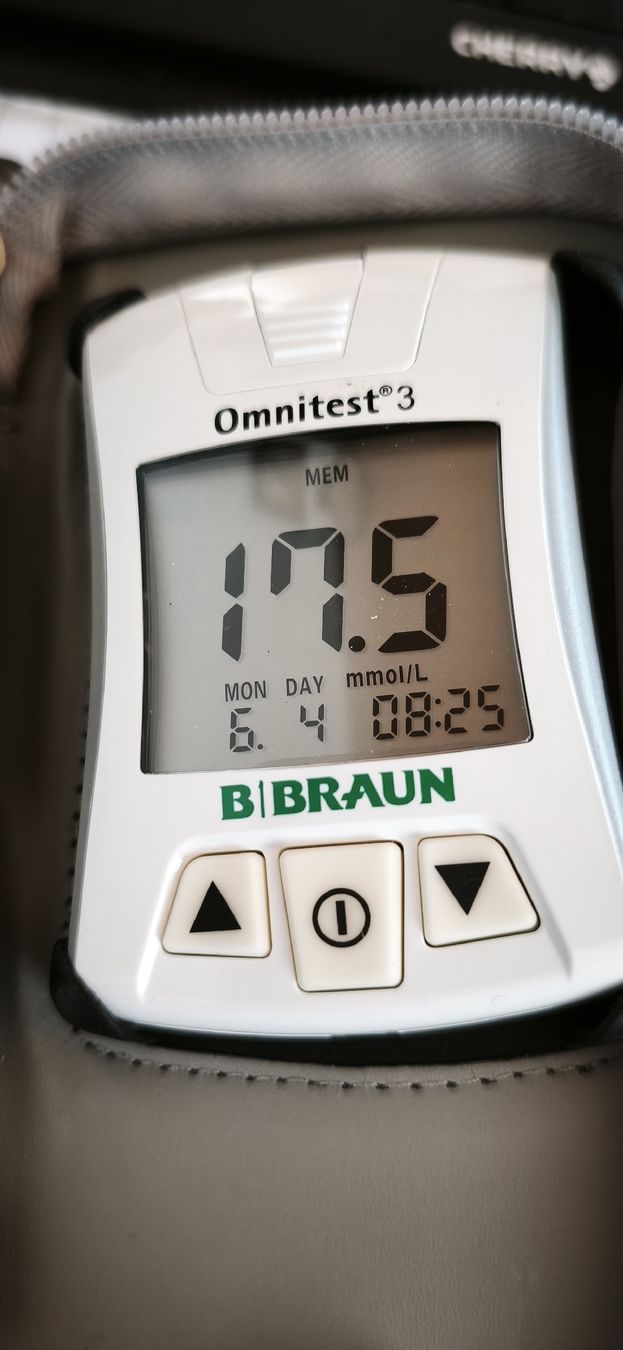 Braun Attrezzature mediche: Omnitest 3 B.Braun glucose meter with lancets – Usato da Weisslingen venduto da nizanra 1