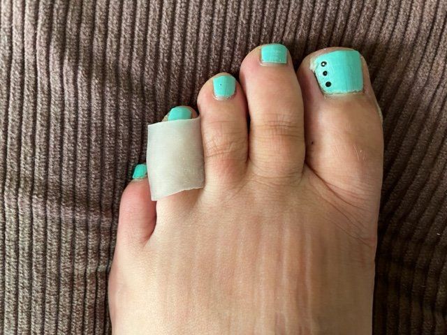 Pedicure: Zehenschutzring G klein.. – Nuovo e nell'imballaggio originale da Nottwil venduto da Frontal 1