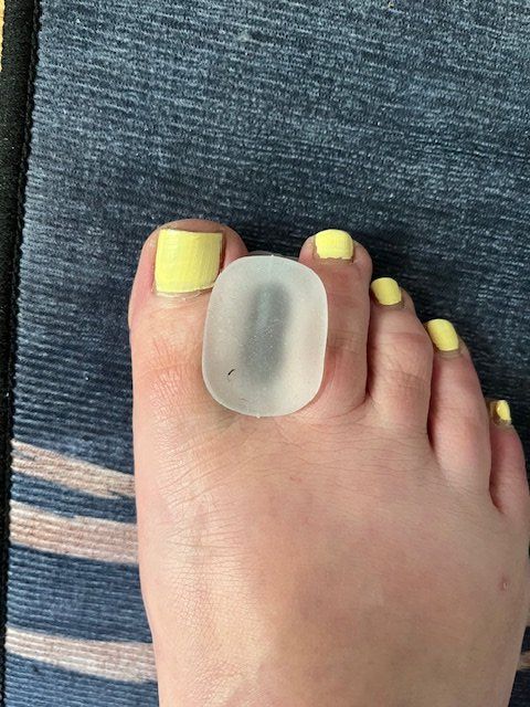 Pedicure: Zehenspreizer G mittel – Nuovo (secondo la descrizione) da Nottwil venduto da Frontal 3