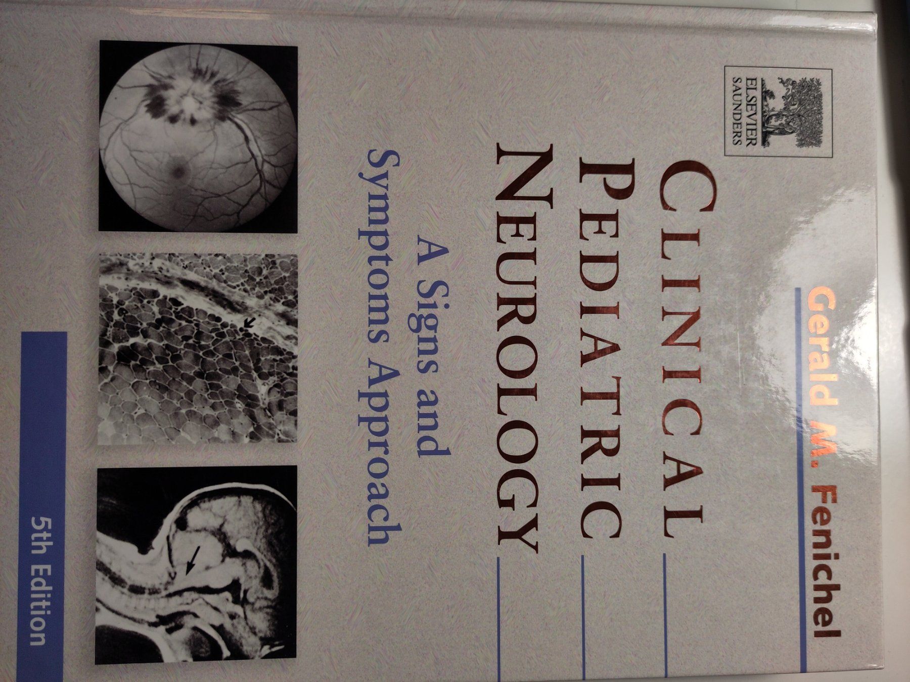 Libri: Clinical Pediatric Neurology – Usato da Bülach venduto da Tiefschlaflos