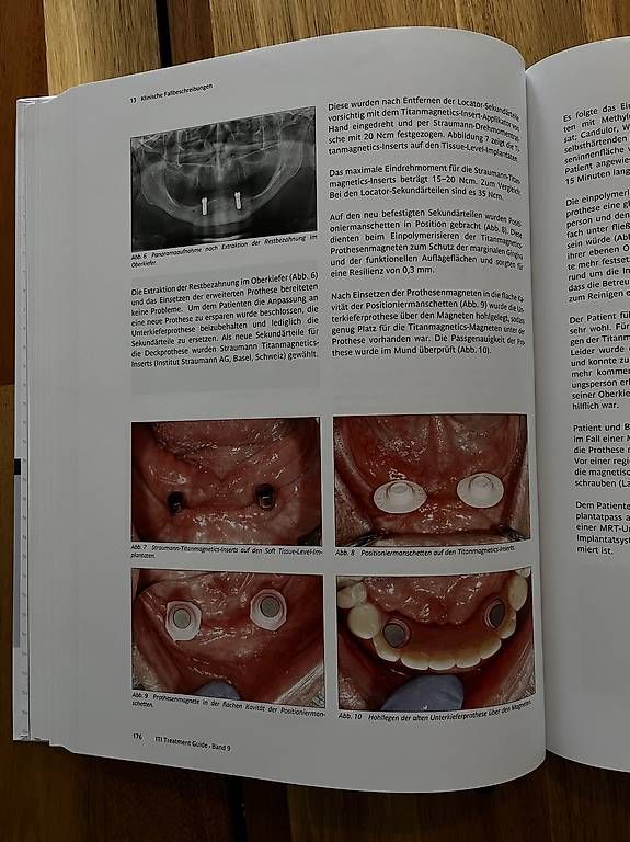 Libri: ITI Treatment Guide Band 9 Deutsch – Usato da Neuhausen am Rheinfall venduto da ram_kw6n 1