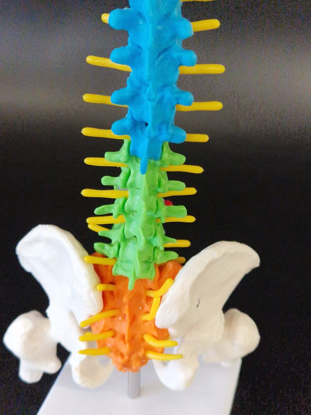 Modellbausätze & Standmodelle: Flexibel Farbiges Anatomisches Wirbelsäulenmodell – Neu (gemäss Beschreibung) aus Muhen von Restwert_Muhen 2