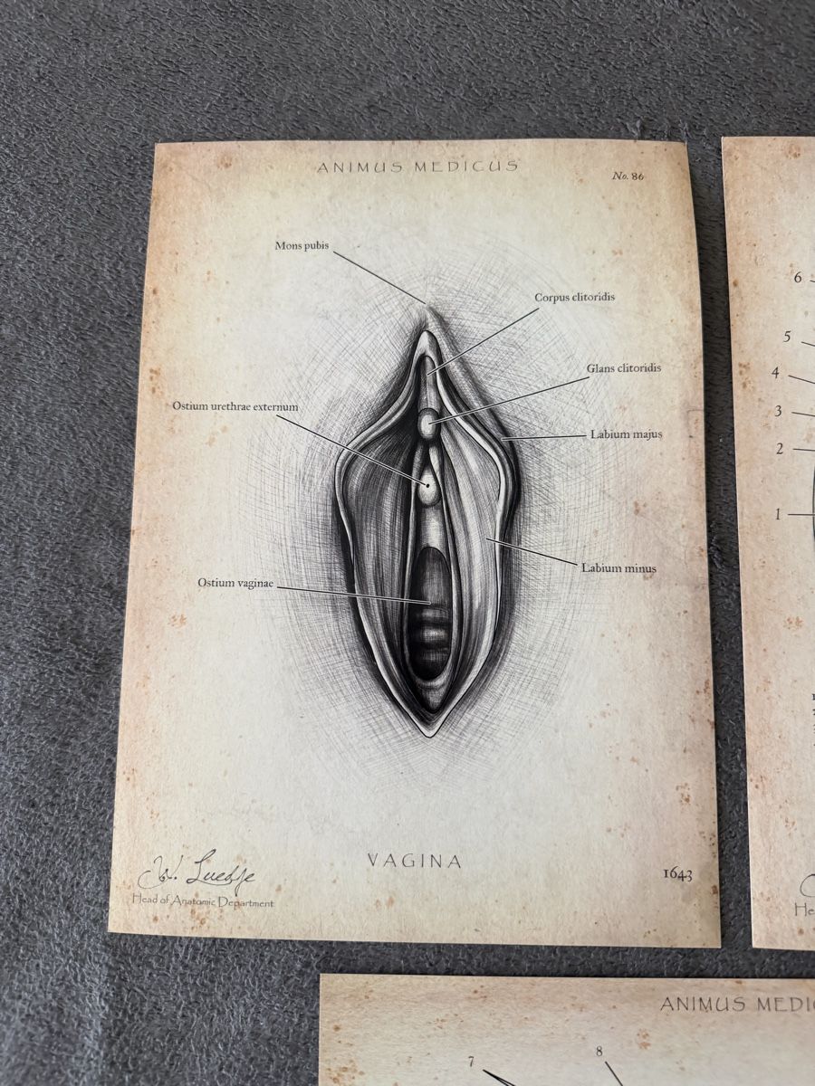 Dipinti: Anatomische ArtPrinte Gemälde Gynäkologie – Usato da St. Gallen venduto da Blackmoon_Flohmarkt 1