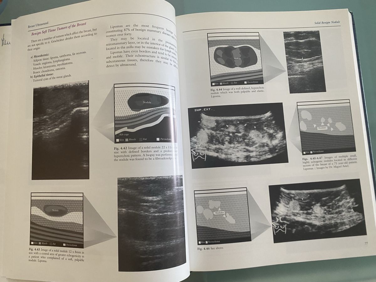 Libri: Lanfranchi - Brustultraschall - Lehrbuch - Second Edition – Usato da Neerach venduto da bar_t2xd 4