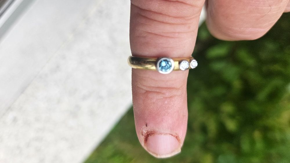Goldring Farbt Ab Krankheit