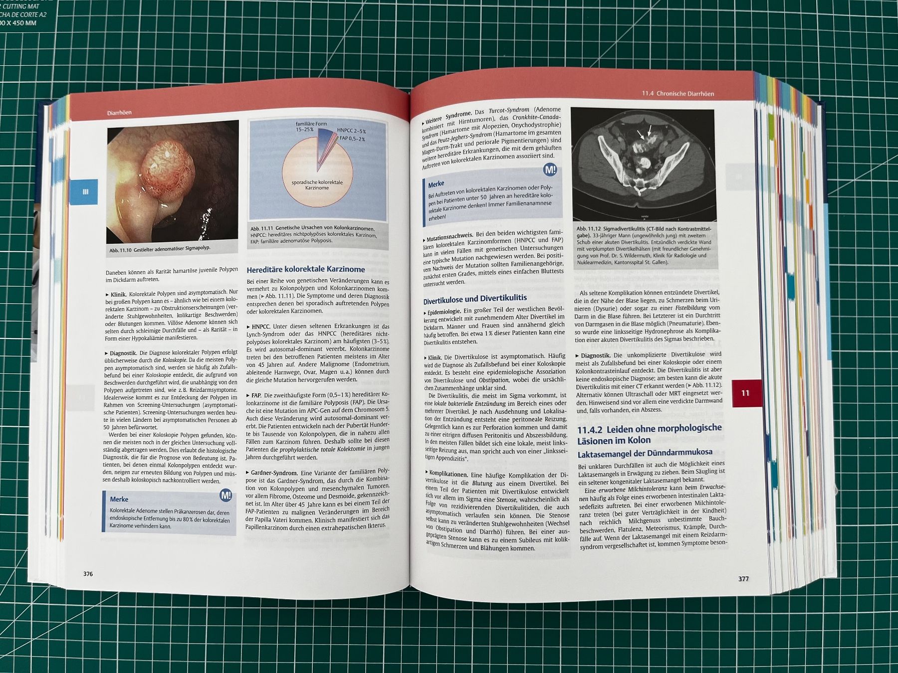 Bücher: Differenzialdiagnose Innerer Krankheiten – Gebraucht aus Bettwiesen von MedMat 2