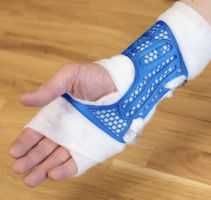 Handgelenksschiene, individuell anpassbar leicht und fest!