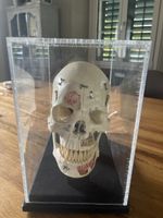 Anatomisches Schädelskelett mit Plexiglas-Vitrine guter Zust