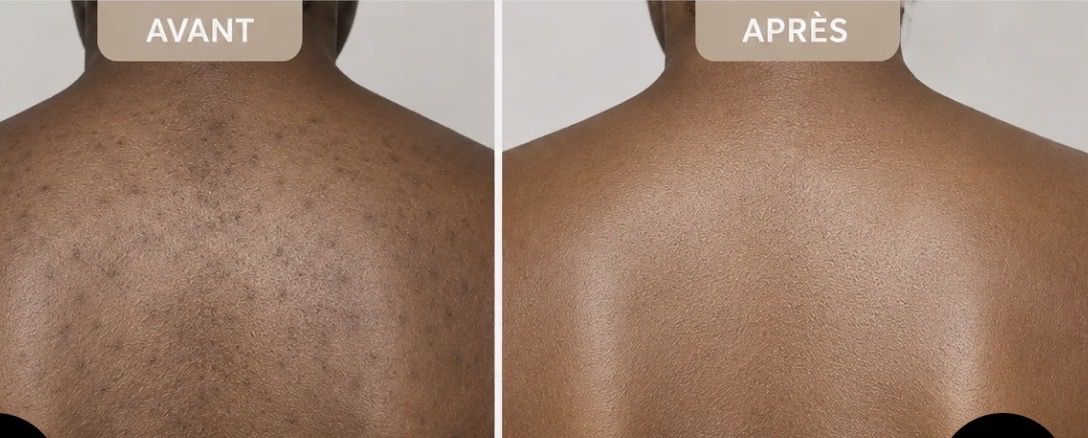 Idratazione: Crème corps anti-imperfections  – Nuovo e nell'imballaggio originale da Genève venduto da tch_dw9w 1