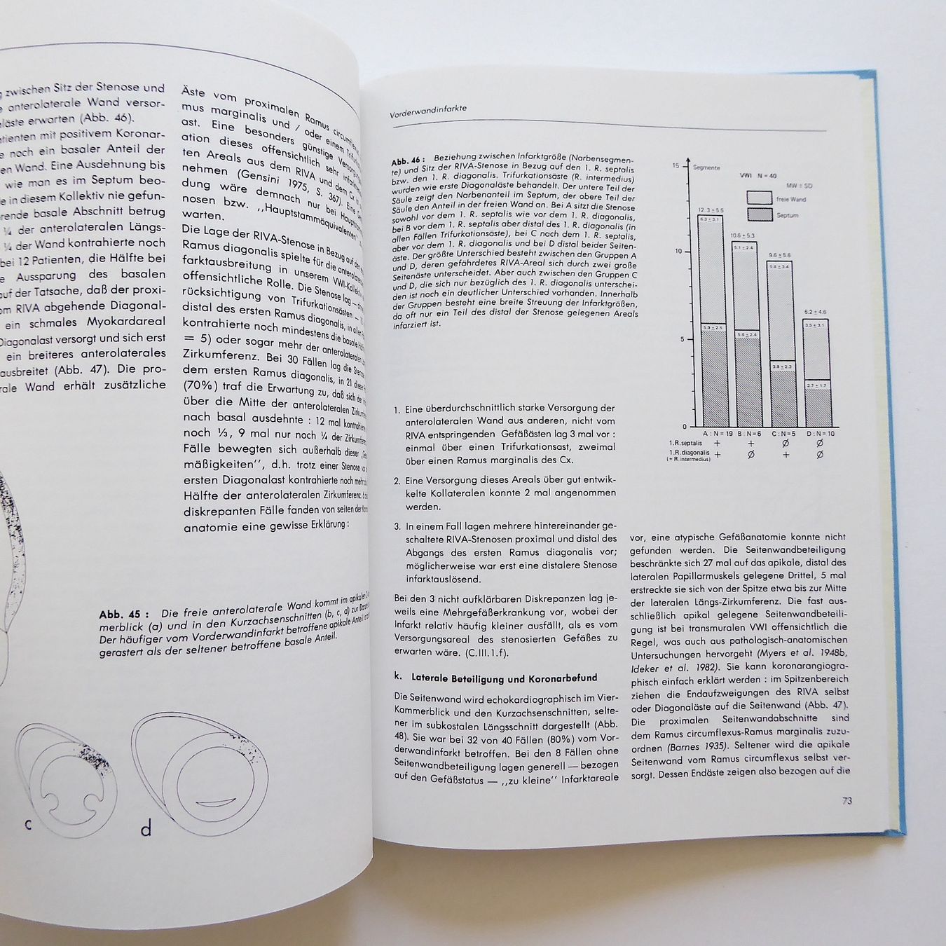 Bücher: Qualitative und quantitative 2D-echokardiographische Topogra – Gebraucht aus Basel von Kunterbunt12 5