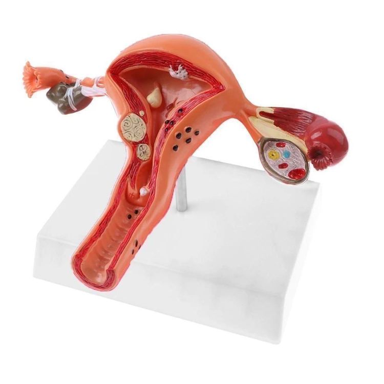 Gebärmutter Anatomie Modell 1:1 (Neu und originalverpackt) in ...