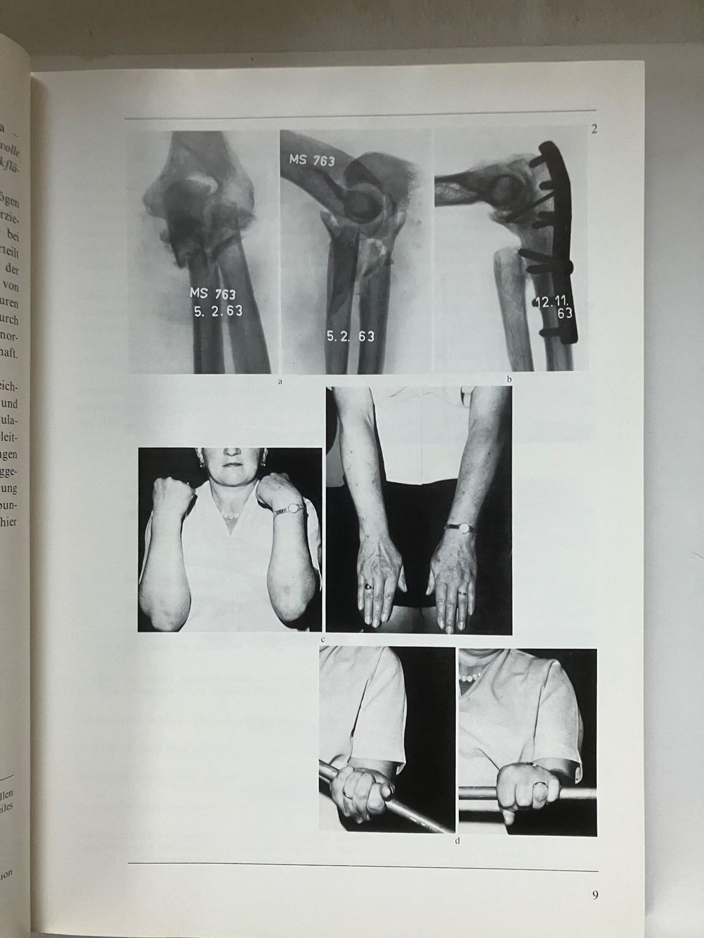 Libri: Manual der Osteosynthese Mülle.Allgöwer.SchneiderWillenegger – Usato da ZUERICH venduto da Carolus1 4
