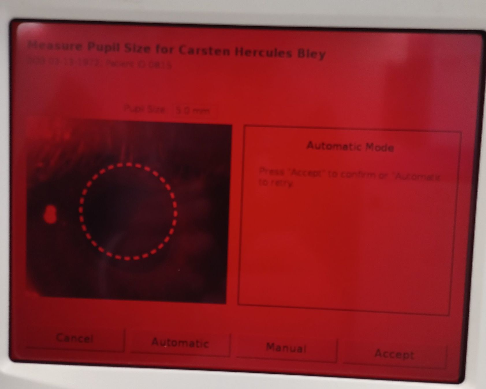 Accessori da laboratorio: Lumithera (Maculogix) AdaptDX Dark Adaptometer – Difettoso da Niederdorf venduto da LeptonAG_Labor 3