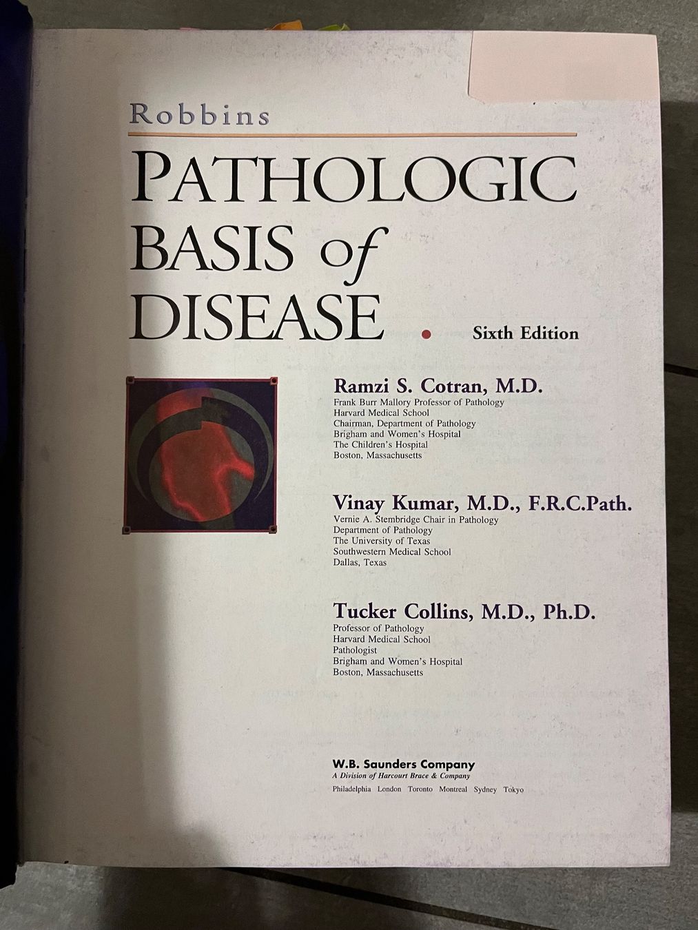 Libri: Robbins Pathologic Basis of Disease – Usato da Gurmels venduto da sar_znc6 1