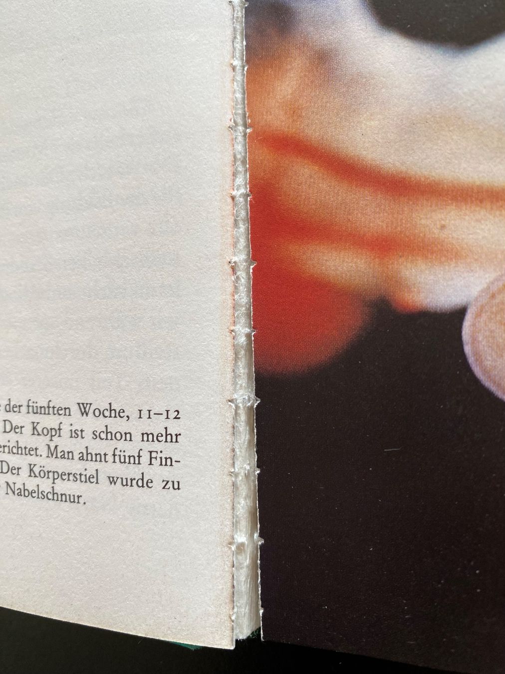 Bücher: Ein Kind entsteht von Lennart Nilsson / 1981 – Gebraucht aus Nussbaumen AG von schuba2000 5