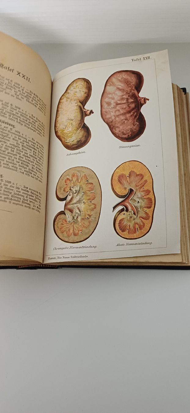 Appareils médicaux: 2 Bücher Neue Heilmethoden Platen  – D'occasion à Grosswangen par Geschenkberatung 3