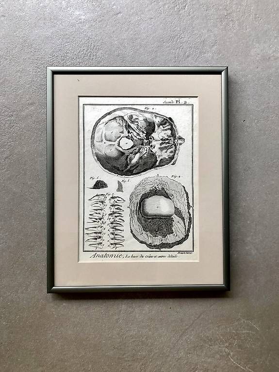 Poster & Bilder: 18. Jahrhundert Kupferstich Robert Benard – Neu und originalverpackt aus Baar von MY1993 1
