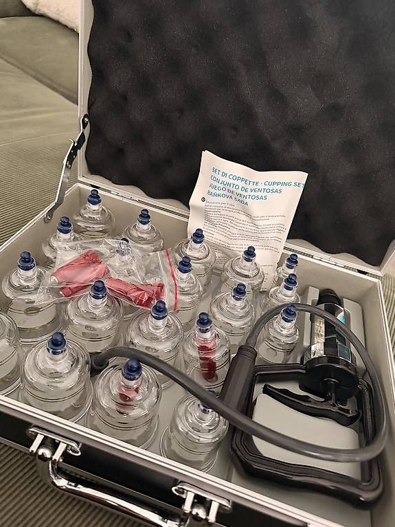 Massagegeräte: Schröpfglas Set im Koffer. Nigelnagelneu – Neu und originalverpackt aus Sennwald von Sennwald28 1