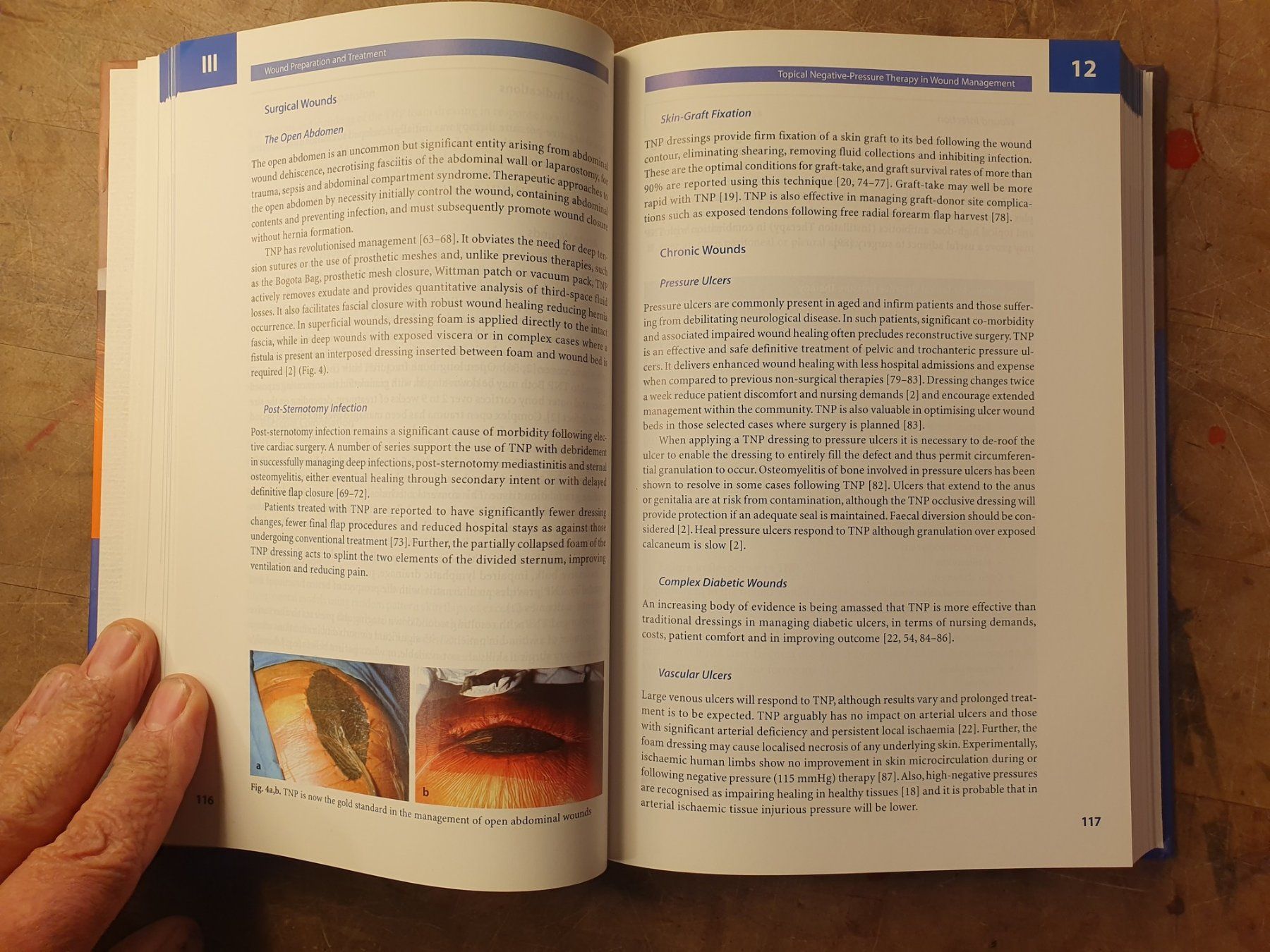 Libri: Surgery In Wounds - Luc Teot – Usato da Zürich venduto da loosebone 6