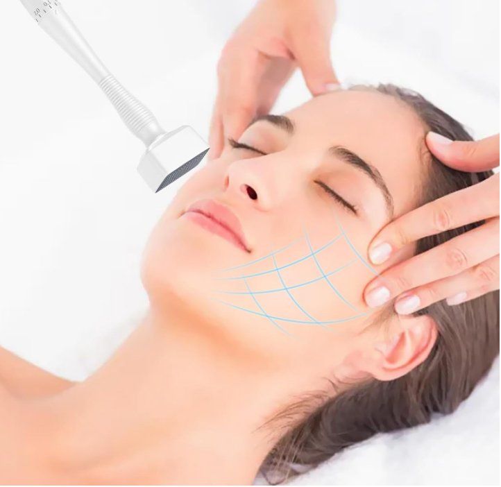 Cura del viso: 0-3.0 mm Einstellbarer, Professionelle Microneedling Stamp – Nuovo (secondo la descrizione) da Thun venduto da 365buy 3