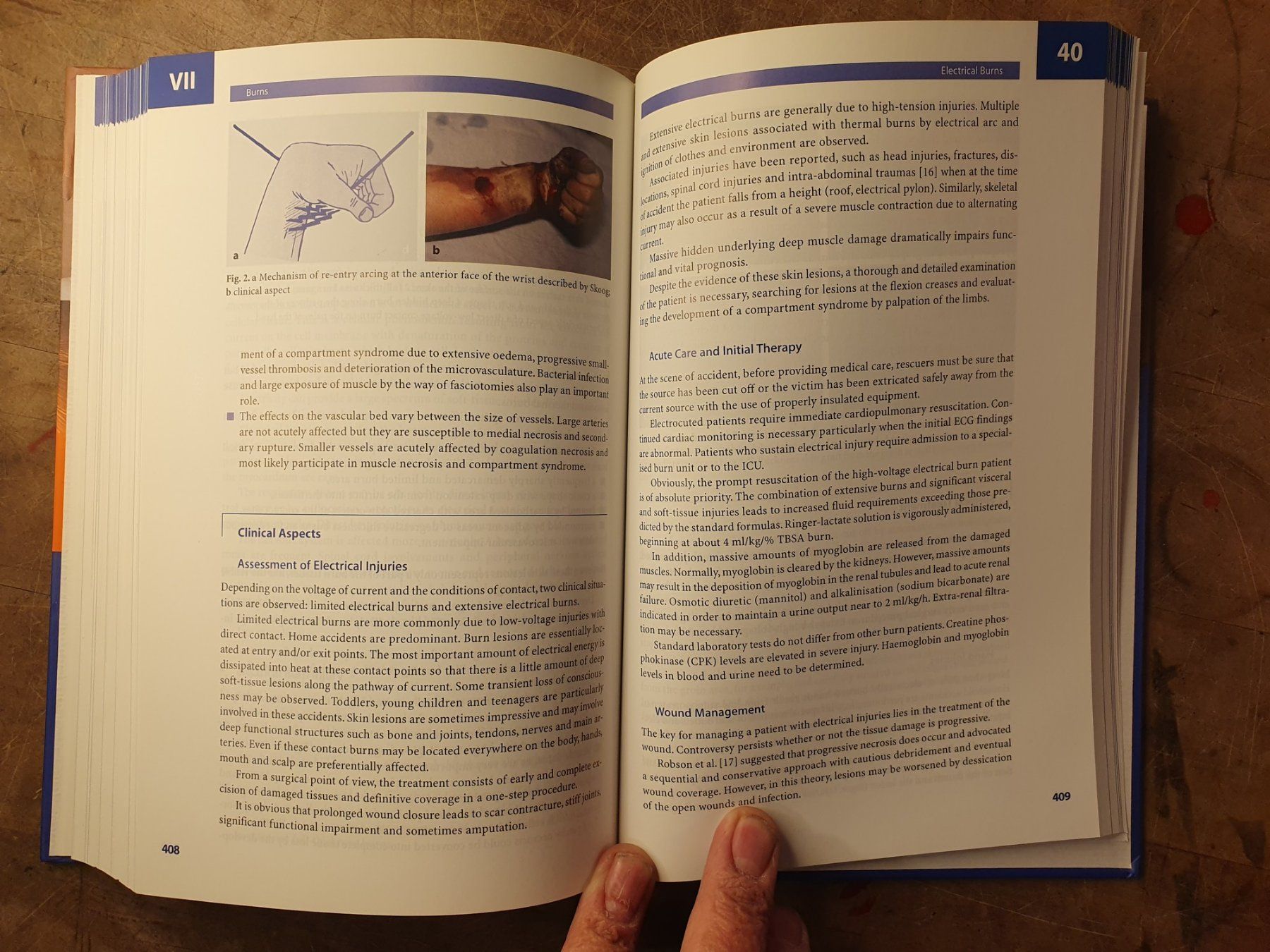 Libri: Surgery In Wounds - Luc Teot – Usato da Zürich venduto da loosebone 8