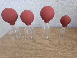 4x Schröpfgläser diverse Grössen