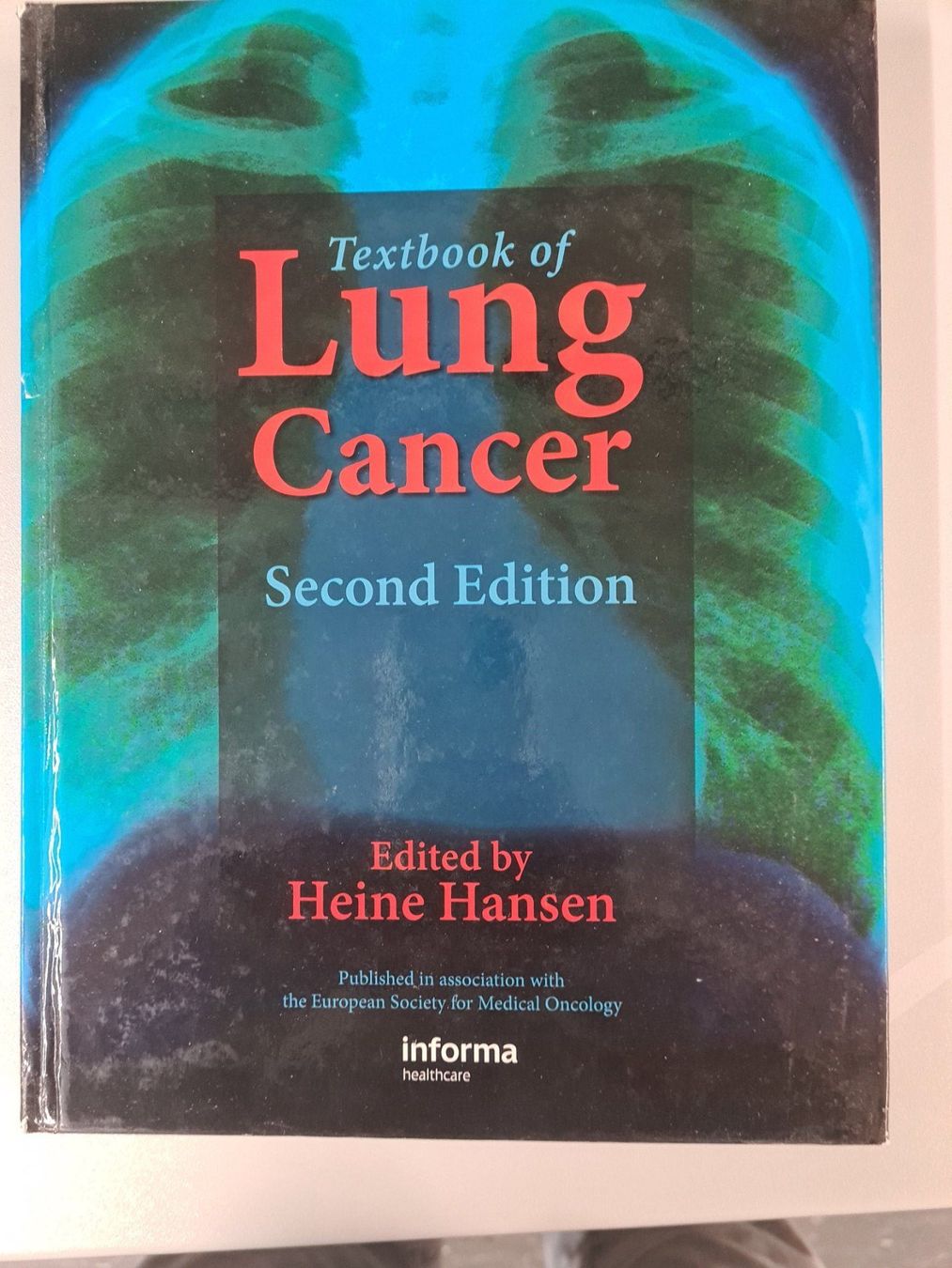Libri: Heine Hansen " Lung Cancer" – Usato da Zürich venduto da ste_sk6k