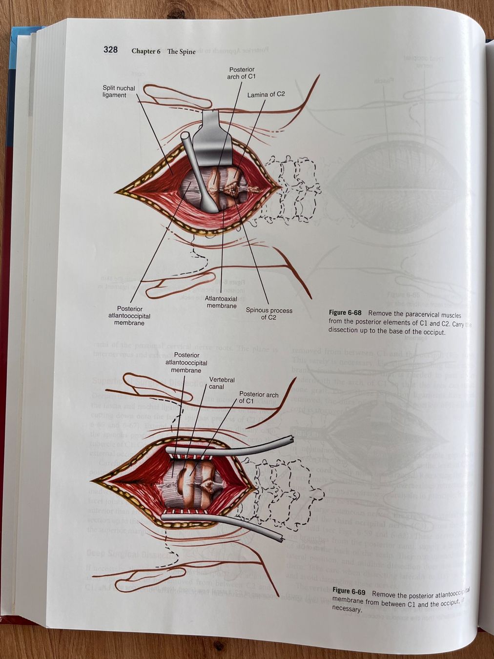 Livres: Surgical Exposures in Orthopaedics: 6th Edition – Neuf (Voir description) à Wittenbach par doa_bfr6 2